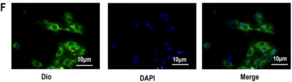 亲脂性细胞膜染料： DiO, Dil, DiR, Did - MedChemExpress