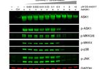 ASK1在氧化应激条件下的激活 | MedChemExpress